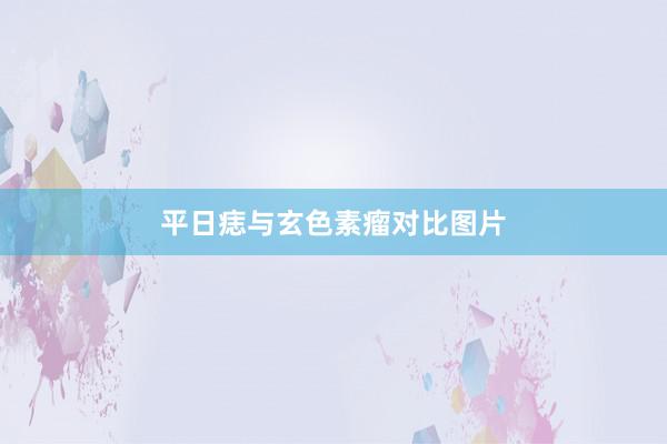 平日痣与玄色素瘤对比图片
